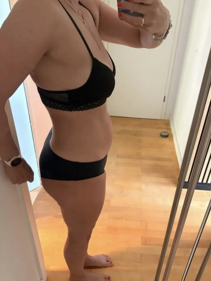 Nicole – Vorher