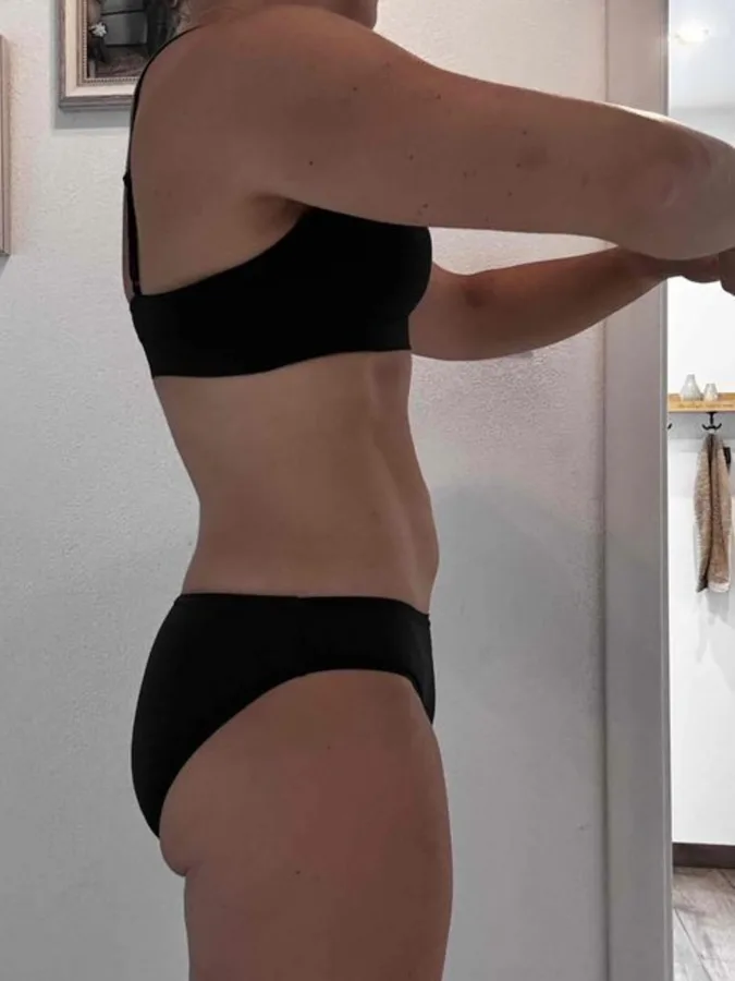 Stefanie – Nachher