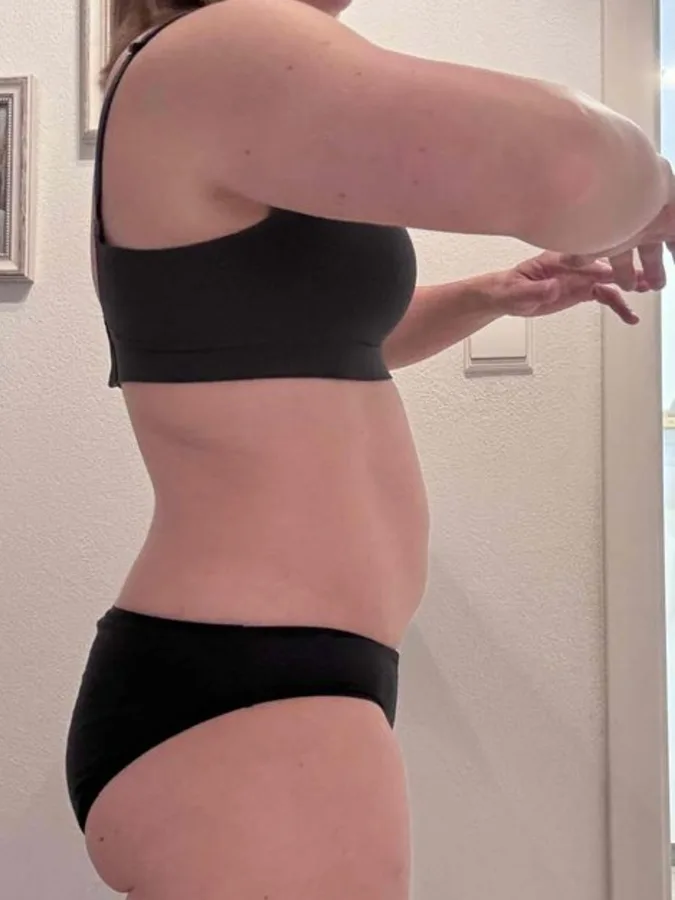 Stefanie – Vorher
